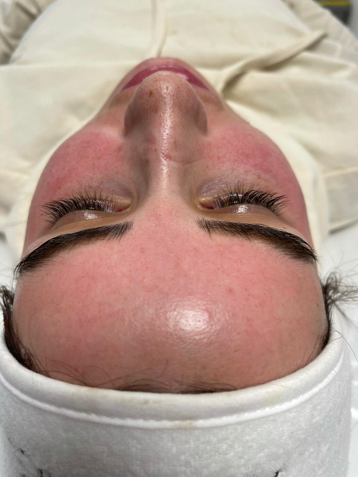 wow facial cardiff london, belfast
