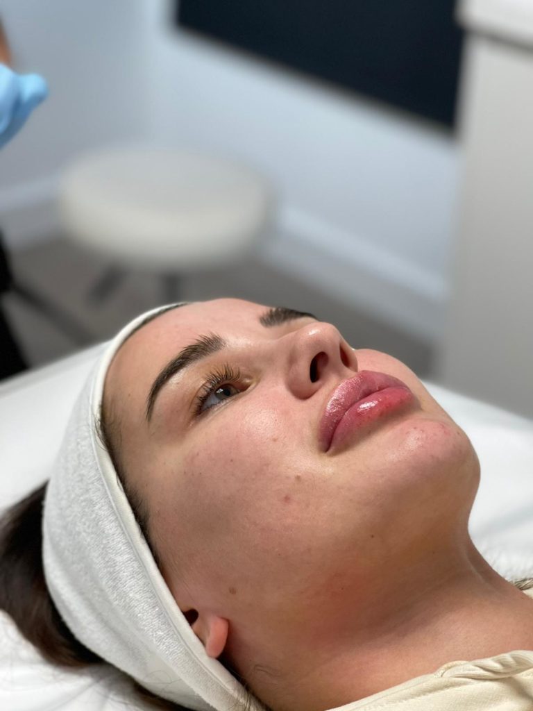wow facial cardiff, london, northern ireland