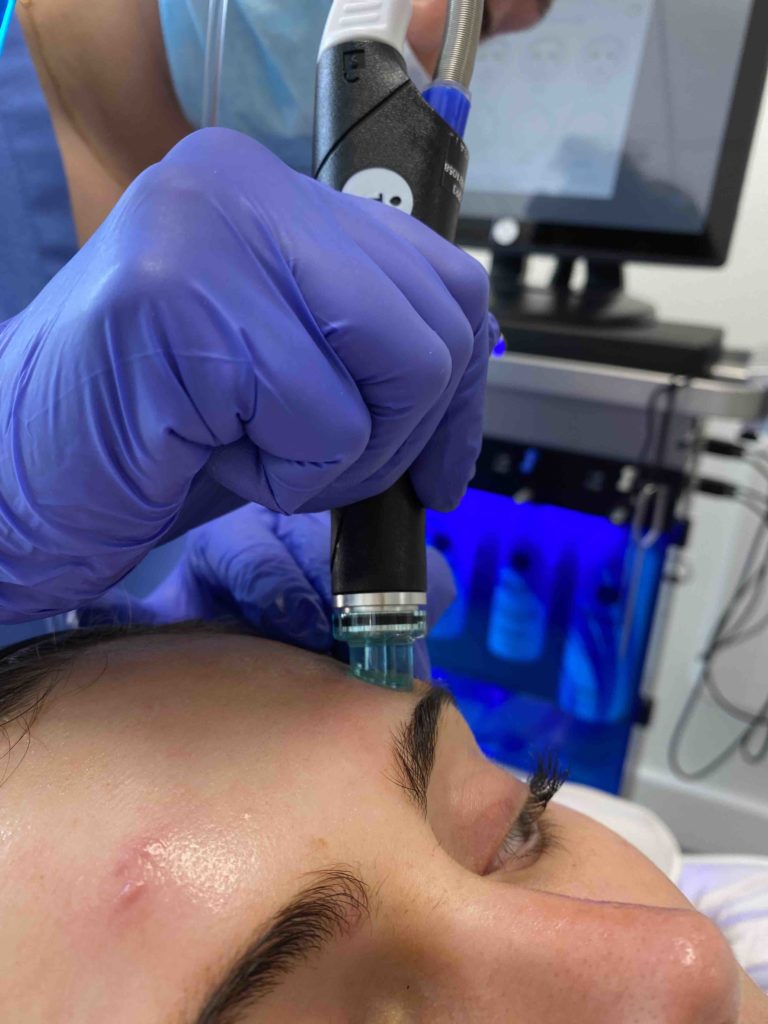 hydrafacial cardiff, london, northern ireland