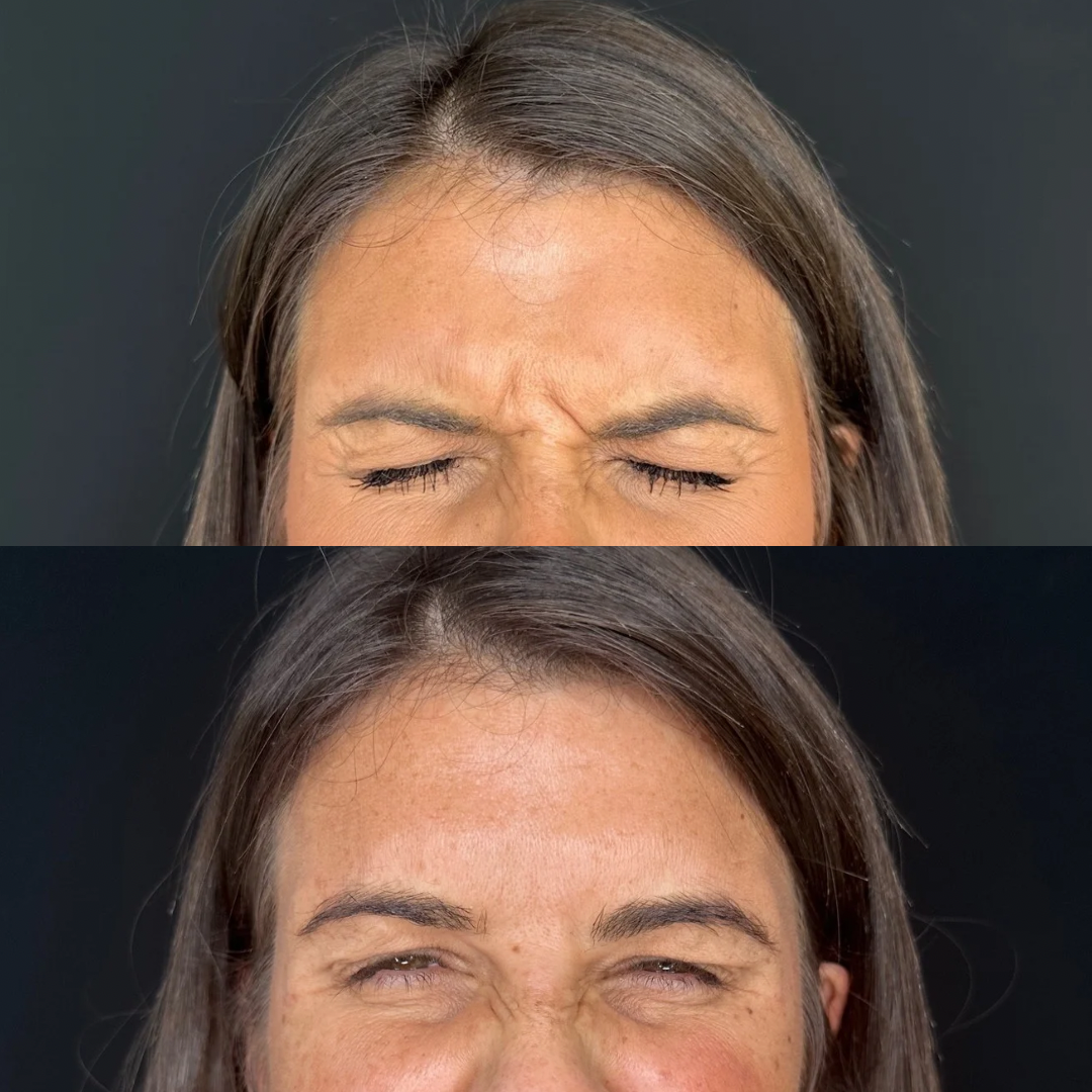 B&A's square 3